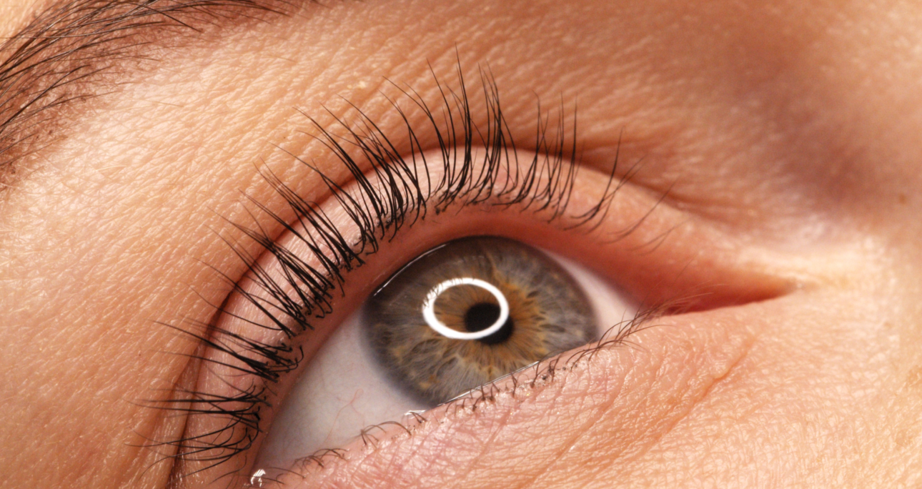 Lifting de Supercílios